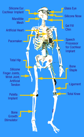 yorick